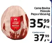 Músculo